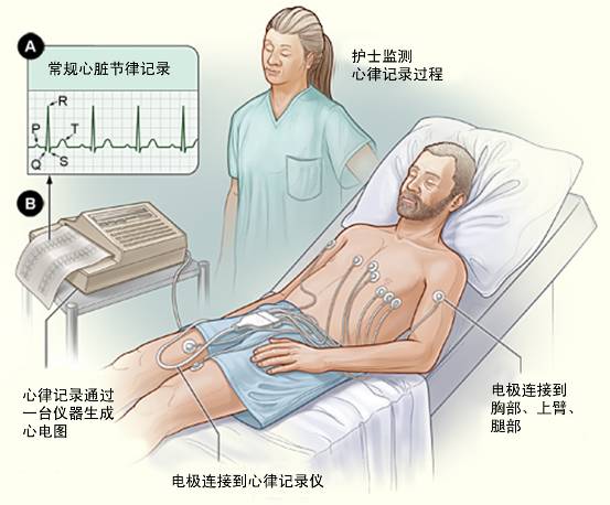 冠心病需要做哪些檢查？(圖1)